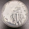 New York Has The Most Cases To Date Of A Deadly Drug-Resistant Fungal Infection 